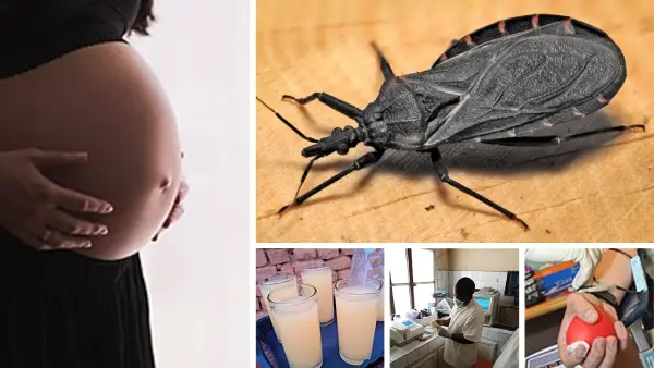 vías de transmisión de la enfermedad de Chagas