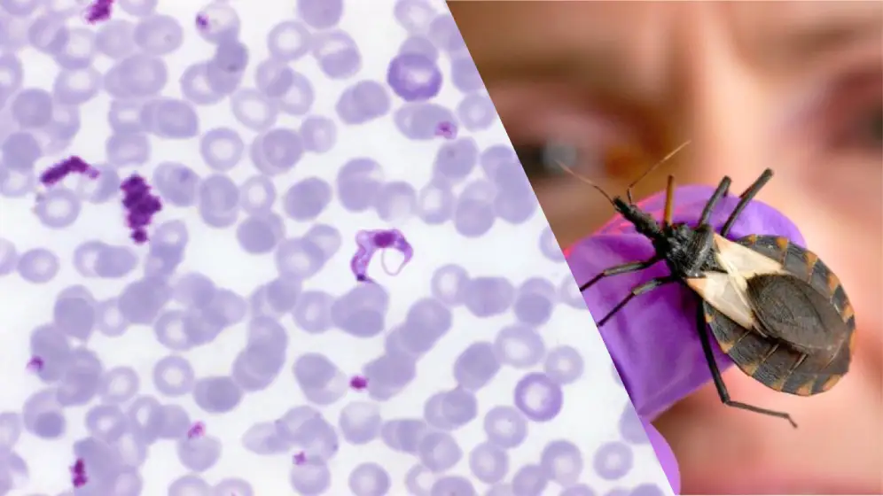 vinchuca y trypanosoma cruzi