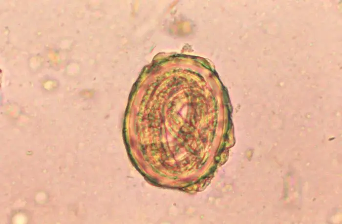 Huevo de parásito Ascaris lumbricoides