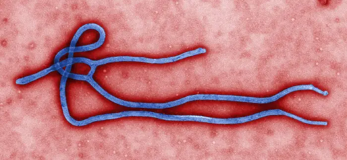 imagen del virus ébola