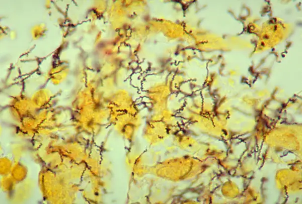 Treponema pallidum