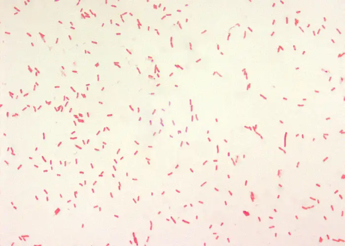 bacterias rojas