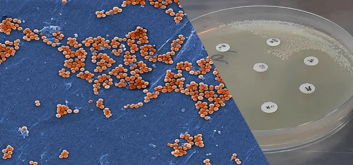 peptidos antimicrobianos