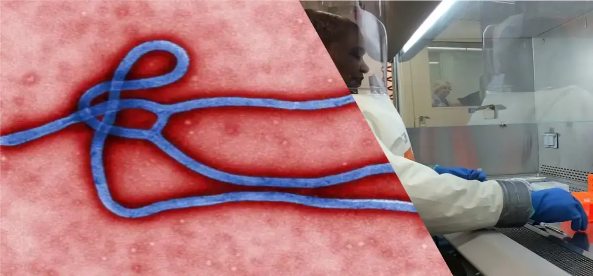 virus ebola y trabajador de laboratorio