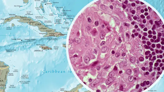 mapa del caribe y leishmaniasis