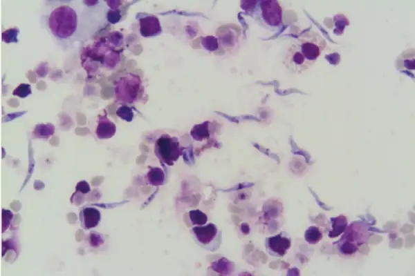 parásito de tripanosoma