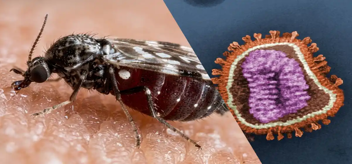 Virus-Shamonda-lo-esencial-sobre-el-primer-caso-humano